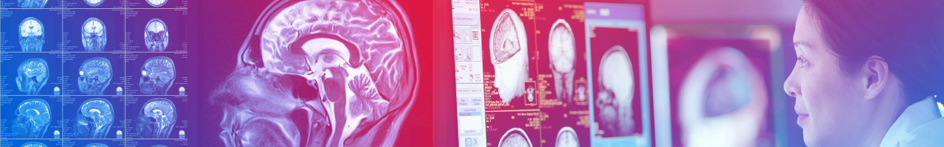 Best Neurologists Melbourne Victoria